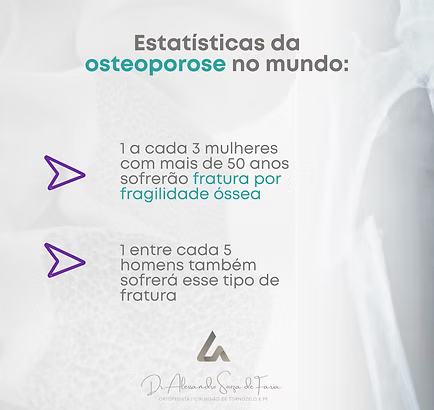 Infográfico: estatísticas da osteoporose no mundo — 1 a cada 3 mulheres acima de 50 anos sofrerão fratura por fragilidade óssea